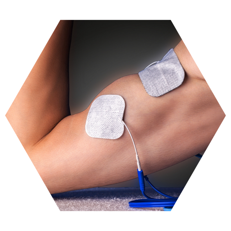 Muscle Stimulation Burlington Physiotherapy and Sports Medicine Centre